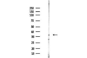 anti-Aflatoxin Beta1 Aldehyde Reductase (AKR7A2) (Internal Region) antibody