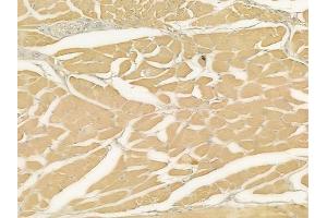 ABIN6262131 and ABIN6272645 at 1/100 staining human tongue carcinoma by IHC-P. (CD235a/GYPA 抗体  (Internal Region))
