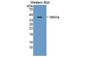 Detection of Recombinant MMP1, Rat using Polyclonal Antibody to Matrix Metalloproteinase 1 (MMP1) (MMP1 抗体  (AA 169-464))