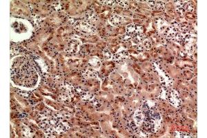 Immunohistochemistry (IHC) analysis of paraffin-embedded Human Kidney, antibody was diluted at 1:100. (CER1 抗体  (Internal Region))