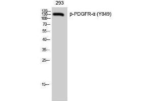 Western Blotting (WB) image for anti-Platelet Derived Growth Factor Receptor alpha (PDGFRA) (pTyr849) antibody (ABIN3179569) (PDGFRA 抗体  (pTyr849))