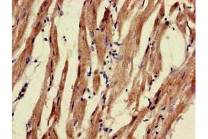 Immunohistochemistry of paraffin-embedded human heart tissue using ABIN7162571 at dilution of 1:100 (PNLIPRP3 抗体  (AA 201-467))