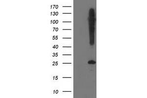 Western Blotting (WB) image for anti-Synaptosomal-Associated Protein, 25kDa (SNAP25) antibody (ABIN1501015)