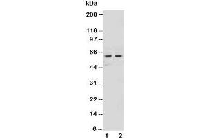 Western blot testing of NOX1 antibody and Lane 1:  HeLa;  2: MCF-7 cell lysate (NOX1 抗体  (AA 354-374))