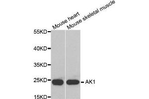 Western blot analysis of extracts of various tissues, using AK1 antibody. (Adenylate Kinase 1 抗体  (AA 1-194))