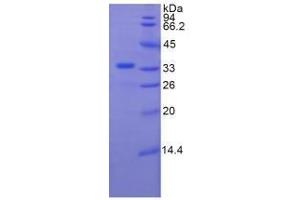 SDS-PAGE analysis of Human Plexin B1 Protein. (PLXNB1 蛋白)