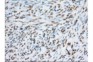 Immunohistochemistry (IHC) image for anti-Transforming, Acidic Coiled-Coil Containing Protein 3 (TACC3) antibody (ABIN1498099) (TACC3 抗体)