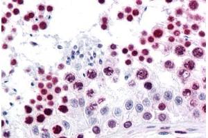 Human Testis: Formalin-Fixed, Paraffin-Embedded (FFPE) (HMGB1 抗体  (AA 1-216))