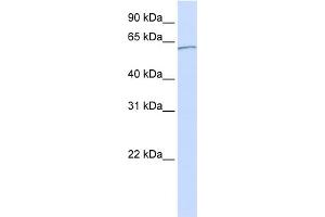 WB Suggested Anti-KPNA5 Antibody Titration: 0. (KPNA5 抗体  (C-Term))