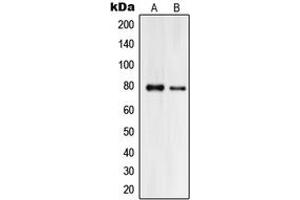 Western blot analysis of Praja2 expression in HeLa (A), HL60 (B) whole cell lysates. (PJA2 抗体  (Center))