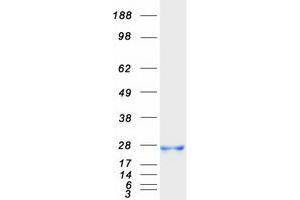 Western Blotting (WB) image for GM2 Ganglioside Activator (GM2A) protein (Myc-DYKDDDDK Tag) (ABIN2722080)