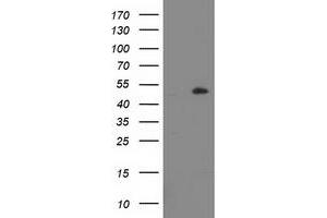 Western Blotting (WB) image for anti-Lipoprotein Lipase (LPL) (AA 28-475) antibody (ABIN1491317) (Lipoprotein Lipase 抗体  (AA 28-475))
