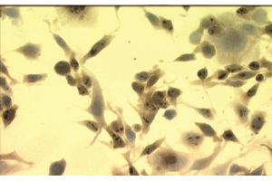 Image no. 3 for anti-Heat Shock Protein 70 (HSP70) (AA 436-503) antibody (ABIN466875) (HSP70 抗体  (AA 436-503))