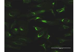 Immunofluorescence of monoclonal antibody to FTL on HeLa cell. (FTL 抗体  (AA 1-175))