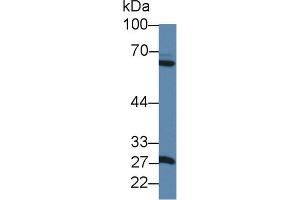 Western blot analysis of Rat Pancreas lysate, using Rat MMP1 Antibody (1 µg/ml) and HRP-conjugated Goat Anti-Rabbit antibody ( (MMP1 抗体  (AA 169-464))