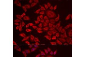 Immunofluorescence analysis of HeLa cells using AGPAT2 Polyclonal Antibody (AGPAT2 抗体)