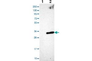 Western blot analysis of Lane 1: Negative control (vector only transfected HEK293T lysate) Lane 2: Over-expression Lysate (Co-expressed with a C-terminal myc-DDK tag (~3. (ANKRD46 抗体)