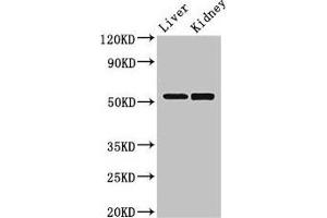 Western Blot Positive WB detected in: Mouse liver tissue, Mouse kidney tissue All lanes: PNLIPRP3 antibody at 3. (PNLIPRP3 抗体  (AA 201-467))
