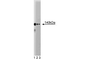 Western blot analysis of CTCF on a Jurkat cell lysate (Human T-cell leukemia, ATCC TIB-152). (CTCF 抗体  (AA 184-290))