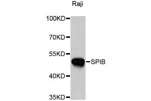 Western blot analysis of extracts of Raji cells, using SPIB antibody. (SPIB 抗体)