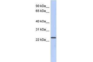 WB Suggested Anti-ULBP1 Antibody Titration:  0. (ULBP1 抗体  (N-Term))