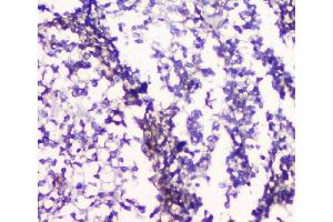 IHC analysis of 5HT2A Receptor using anti-5HT2A Receptor antibody (ABIN3042729).