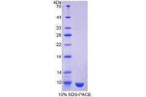 SDS-PAGE analysis of Human Clara Cell Protein 16 Protein. (SCGB1A1 蛋白)