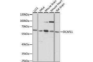 Western blot analysis of extracts of various cell lines, using DC antibody (ABIN7266680) at 1:1000 dilution. (DCAF11 抗体  (AA 1-170))