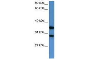 Image no. 1 for anti-serine/threonine/tyrosine Interacting-Like 1 (STYXL1) (AA 140-189) antibody (ABIN6746820) (STYXL1 抗体  (AA 140-189))
