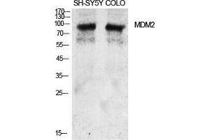 Western Blot (WB) analysis of specific cells using MDM2 Polyclonal Antibody. (MDM2 抗体  (Ser880))