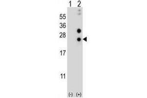 Western blot analysis of CSN1S1 (arrow) using rabbit polyclonal CSN1S1 Antibody (Center) . (Casein alpha S1 抗体  (Middle Region))