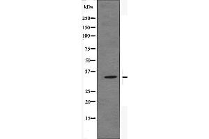 Western blot analysis of OR51E2 Antibody expression in JK cells lysates. (PSGR 抗体  (Internal Region))