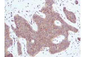 Image no. 2 for anti-Chemokine (C-X-C Motif) Ligand 10 (CXCL10) antibody (ABIN465011) (CXCL10 抗体)