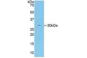 Detection of Recombinant F5, Human using Polyclonal Antibody to Coagulation Factor V (F5) (Coagulation Factor V 抗体  (AA 1979-2217))