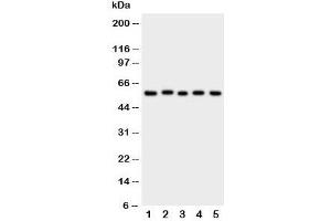 Western blot testing of ASIC3 antibody and Lane 1:  rat brain;  2: (r) testis;  3: human U87;  4: mouse Neuro-2a;  5: (h) SMMC-7721 cell lysate. (ASIC3 抗体  (N-Term))