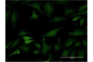 Immunofluorescence of monoclonal antibody to BCL7C on HeLa cell. (BCL7C 抗体  (AA 86-164))