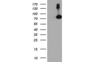 Western Blotting (WB) image for anti-F-Box Protein 21 (FBXO21) antibody (ABIN1498236) (FBXO21 抗体)