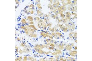 Immunohistochemistry of paraffin-embedded human stomach using INADL antibody at dilution of 1:100 (x40 lens). (PATJ 抗体)