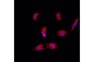 ABIN6257639 and ABIN6274782 staining Hela by IF/ICC. (RPL39 抗体  (C-Term))