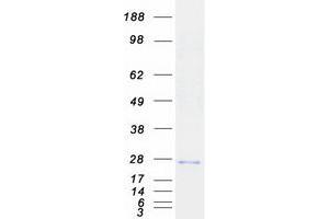 Validation with Western Blot