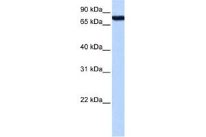 WB Suggested Anti-ZNF33A Antibody Titration:  0. (ZNF33A 抗体  (Middle Region))