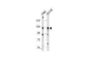 All lanes : Anti-AXL Antibody at 1:2000 dilution Lane 1: Hela whole cell lysate Lane 2: D whole cell lysate Lysates/proteins at 20 μg per lane. (AXL 抗体)