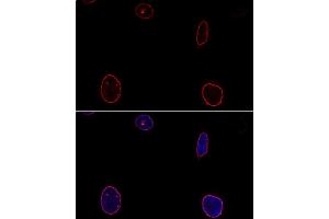 Confocal immunofluorescence analysis of U-2OS cells using Emerin/Emerin/EMD antibody  at dilution of 1:100. (Emerin 抗体  (AA 1-220))