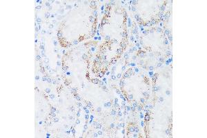 Immunohistochemistry of paraffin-embedded Rat kidney using GTPBP8 Rabbit pAb (ABIN7267527) at dilution of 1:100 (40x lens). (GTPBP8 抗体  (AA 1-170))