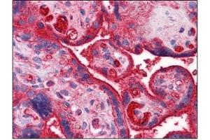 Immunohistochemistry (IHC) image for anti-Apolipoprotein A-II (APOA2) (AA 1-101) antibody (ABIN614396) (APOA2 抗体  (AA 1-101))