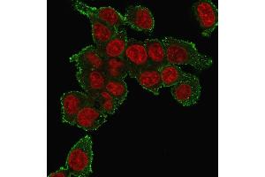 Immunofluorescence staining of HePG2 cells using TNF alpha Mouse Monoclonal Antibody (TNF706) followed by goat anti-mouse IgG-CF488 (green). (TNF alpha 抗体  (N-Term))