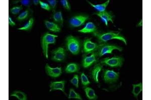 Immunofluorescence staining of A549 cells with ABIN7169288 at 1:66, counter-stained with DAPI. (PP5 抗体  (AA 370-488))