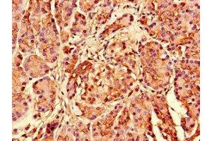 Immunohistochemistry of paraffin-embedded human pancreatic tissue using ABIN7142536 at dilution of 1:100 (RPS26 抗体  (AA 2-115))