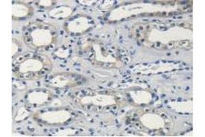 Immunohistochemistry (IHC) image for anti-Proteasome (Prosome, Macropain) 26S Subunit, ATPase, 4 (PSMC4) (AA 1-418) antibody (ABIN7442066)