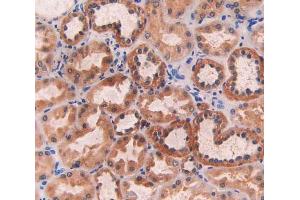 IHC-P analysis of kidney tissue, with DAB staining. (ECT2 抗体  (AA 453-647))